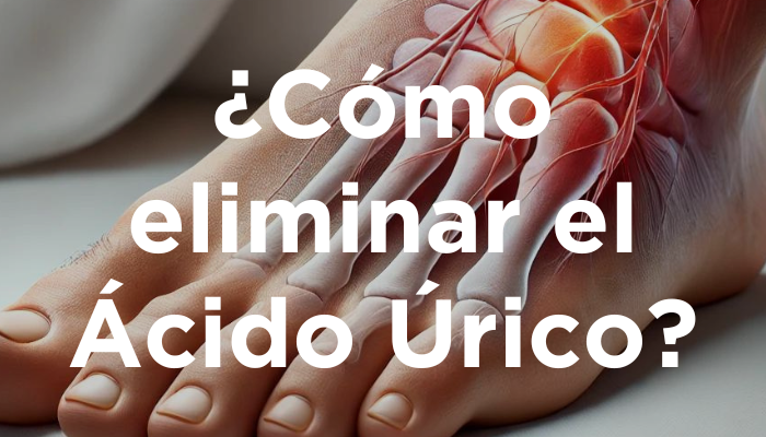 ¿Cómo Eliminar El Ácido Úrico?